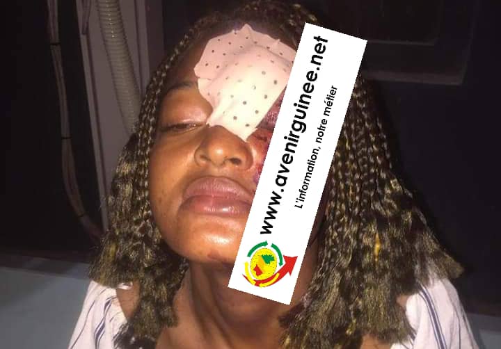 les violences basées sur le genre