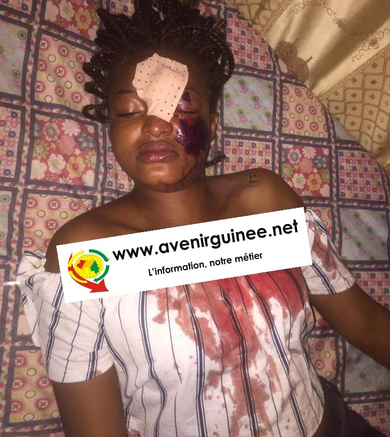 les violences basées sur le genre