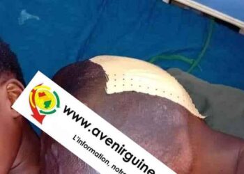 SOS  pour Aissatou Diallo, 14 ans, soufrante de tumeur sur l&rsquo;épaule