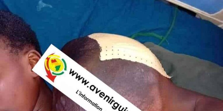 SOS  pour Aissatou Diallo, 14 ans, soufrante de tumeur sur l&rsquo;épaule