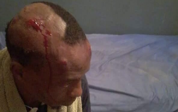 Manif contre le CNRD: plusieurs militants de l’UFDG interpelés, certains blessés