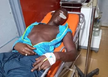 Pris pour un voleur, Adama sévèrement tabassé par des mécaniciens à Conakry