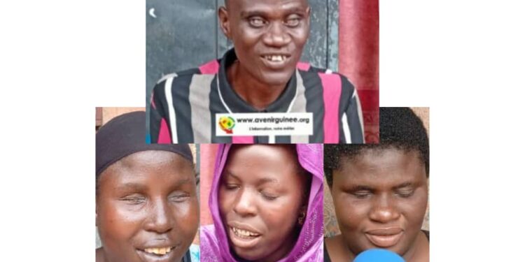 Kagbelen : trois femmes aveugles, leur mari aussi aveugle et leurs 16 enfants lancent un appel à l’aide