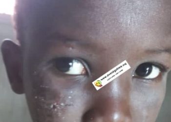 Horreur à Mamou : un père accusé d’avoir infligé des sévices graves à son fils de cinq ans