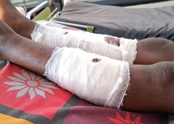 Labé : Une attaque à main armée fait deux blessés à Missidé Hindé
