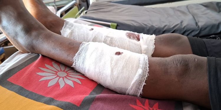 Labé : Une attaque à main armée fait deux blessés à Missidé Hindé
