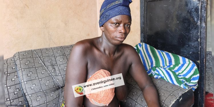 Rongée par la maladie, Aminata Youla lance un appel à l’aide d’urgence