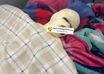 Labé : un apprenti de 14 ans frôle le pire après avoir été brûlé au feu